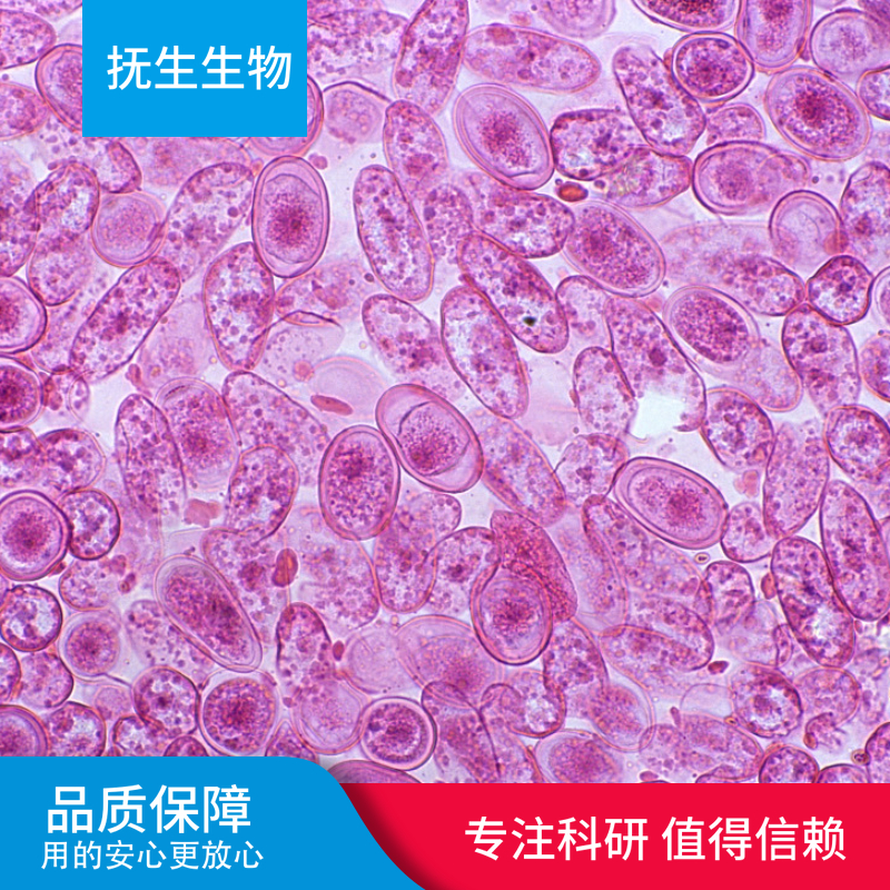 人眼脉络黑色素瘤细胞带荧光素酶；OCM1A/LUC (STR)