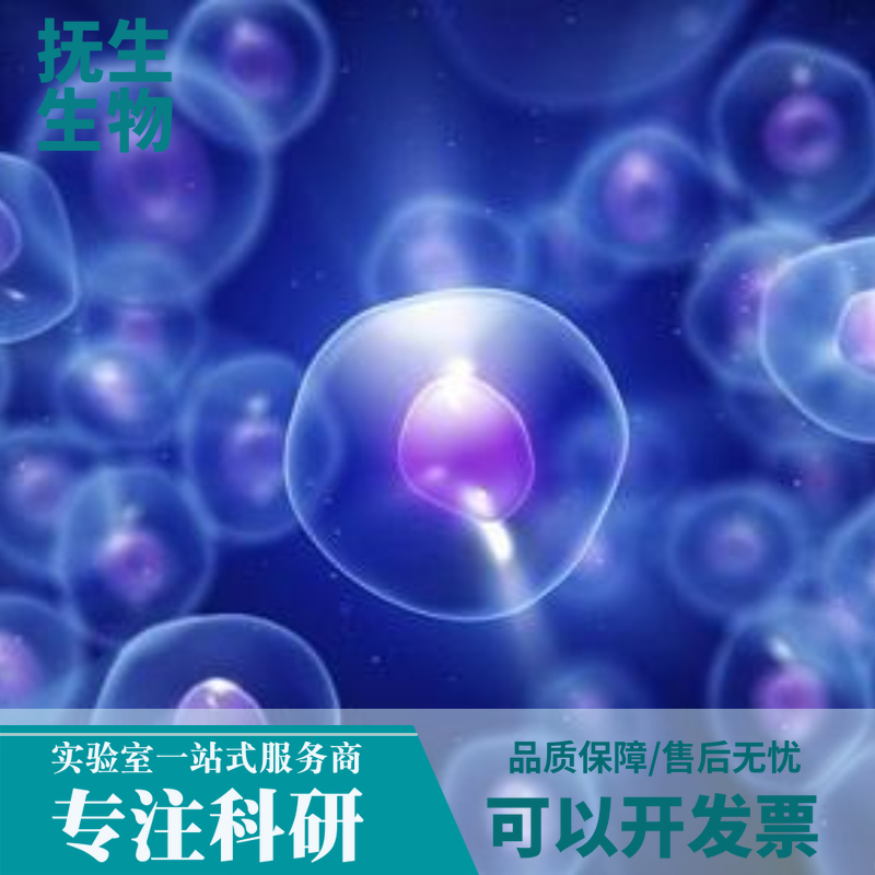 人结直肠腺癌细胞带绿色荧光；LS174T/GFP