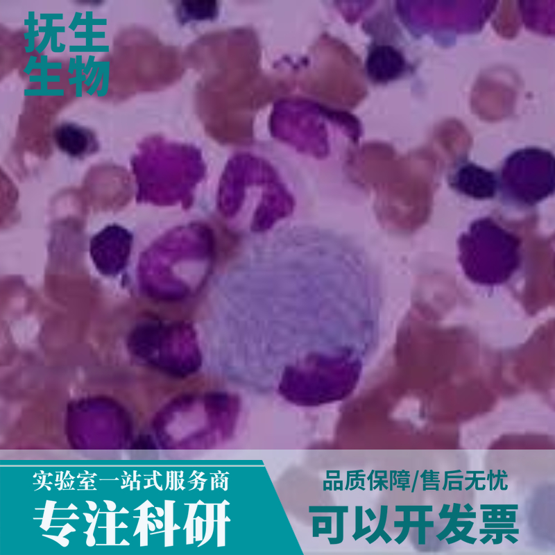 人乳腺癌细胞；SUM149PT