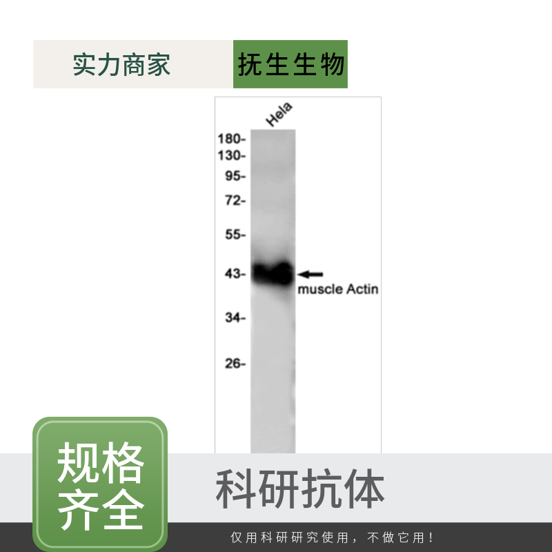 X染色体开放阅读框21抗体