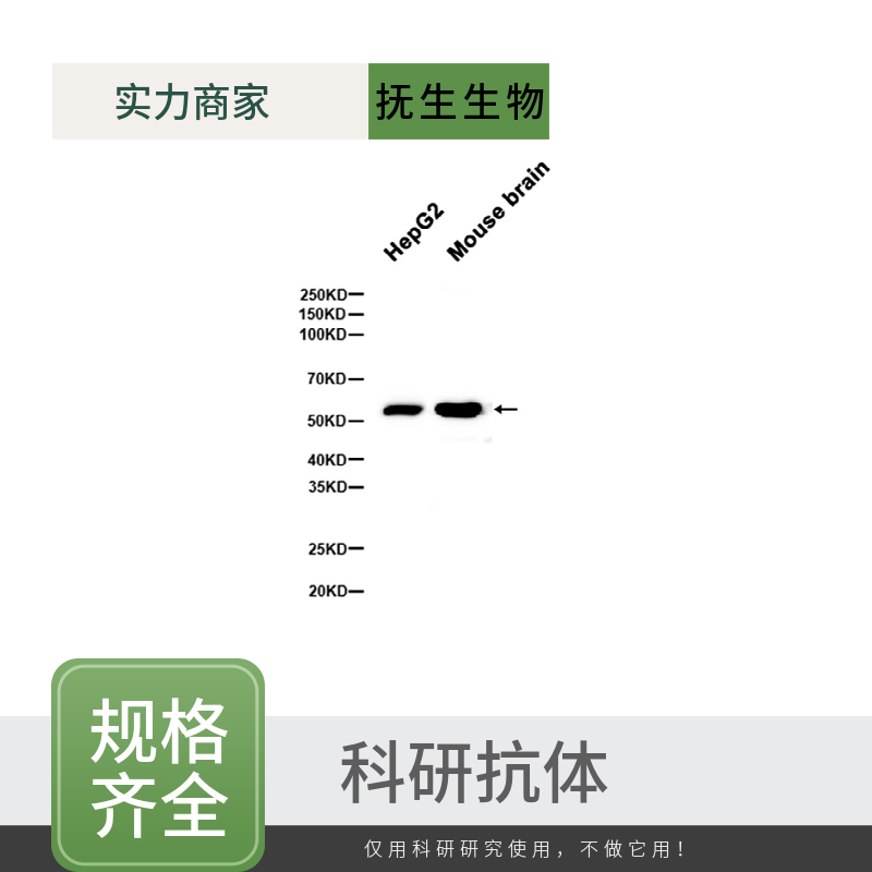 β2-微球蛋白抗体