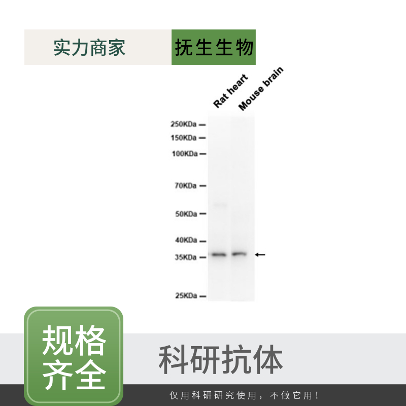 β淀粉样肽（1-42）抗体