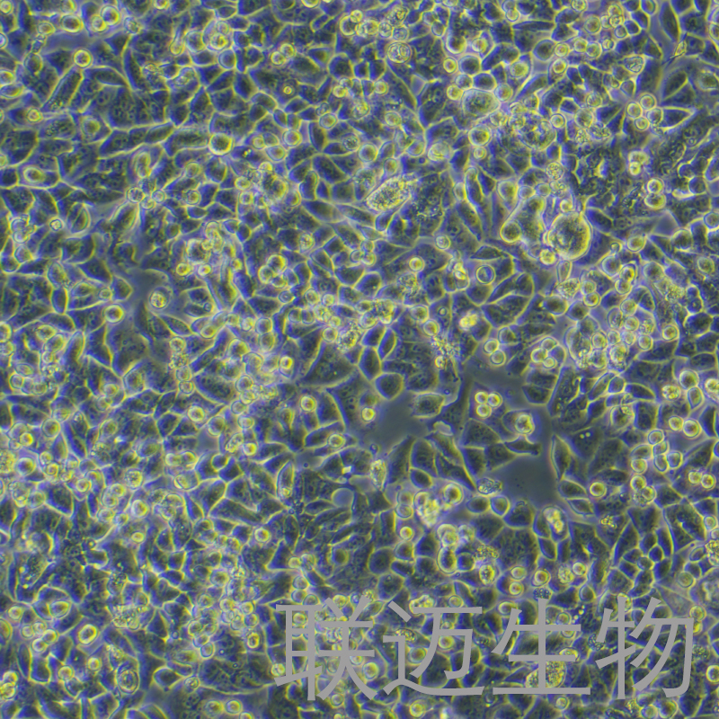 SK-BR-3-LUC细胞（乳腺癌细胞+LUC（非三阴）） LM8C0223-L