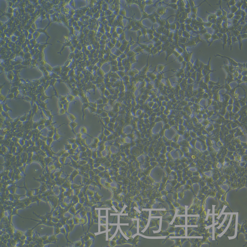 Phoenix-ECO细胞（逆转录病毒包装细胞系）LM8C1218