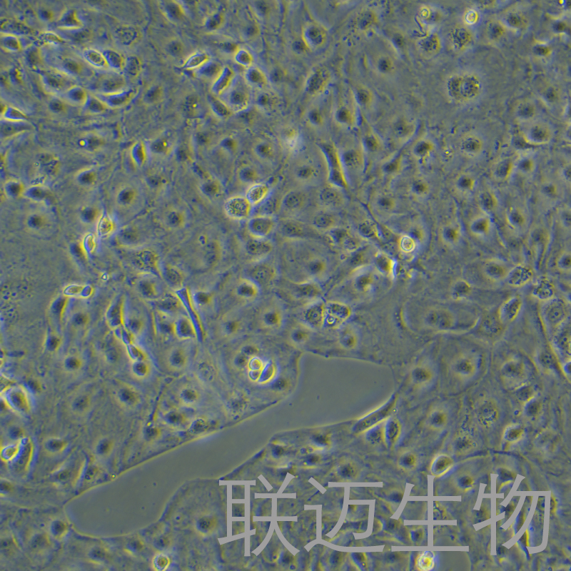 KURAMOCHI细胞（卵巢癌细胞）LM8C1075