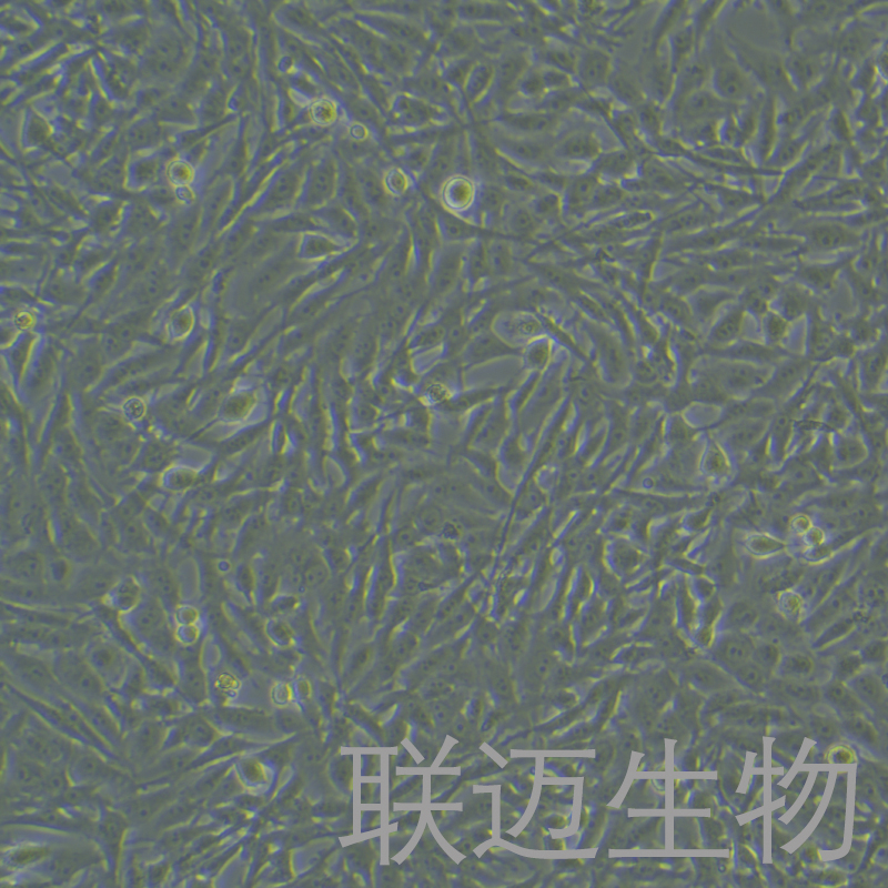 U251MG细胞（类星型胶质细胞瘤）LM8C1081