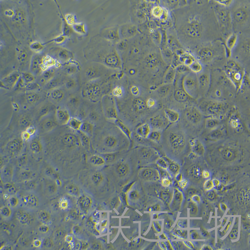 LTEP-s细胞（肺鳞癌细胞）LM8C1230