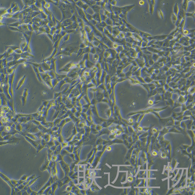 HCC1395细胞（乳腺癌细胞 （三阴性））LM8C1234