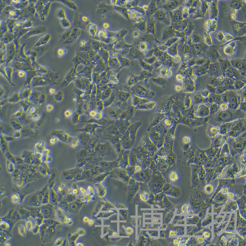 Hepa1-6/Lenvatinib（小鼠肝癌细胞仑伐替尼耐药株）YB-72105MCD