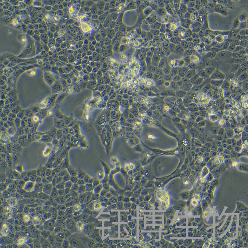 CAL-33（人舌鳞癌细胞）YB-70495HC