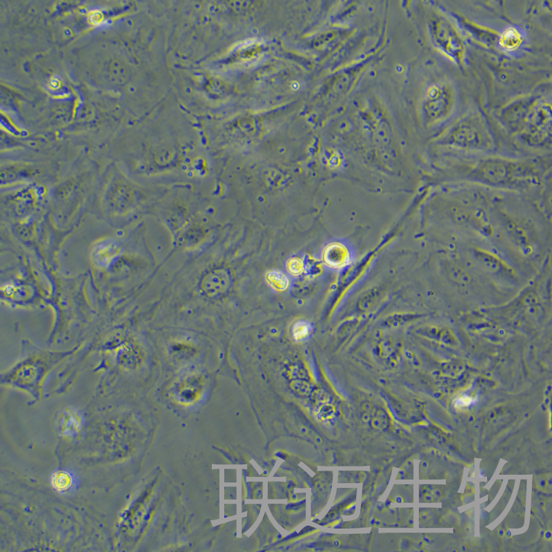 HUH-28细胞（胆管癌细胞）LM8C1122
