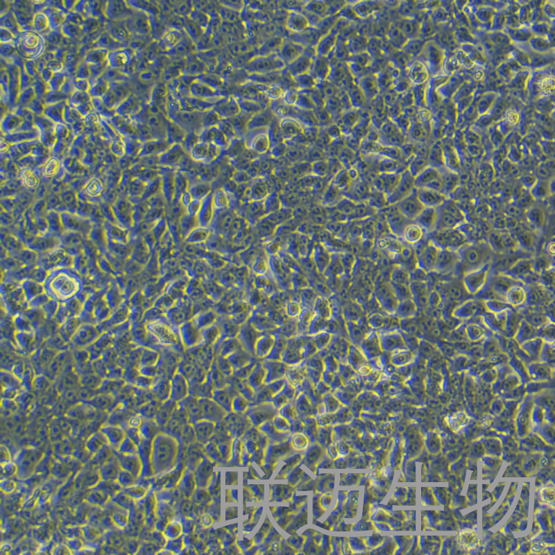 KYSE-450细胞（食管鳞癌细胞）LM8C1246