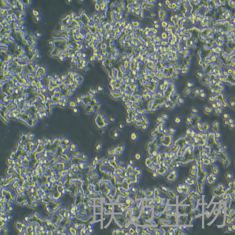 NCI-H810细胞（非小细胞肺癌细胞）LM8C1149