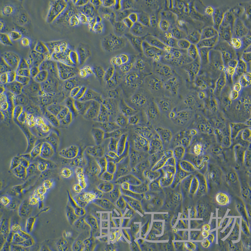 IGROV-1细胞（卵巢子宫内膜样腺癌）LM8C1137