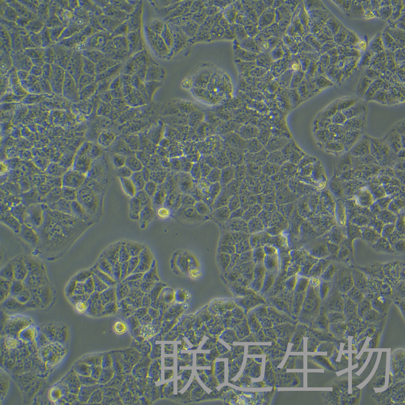 Huh-1细胞（肝癌细胞）LM8C1116