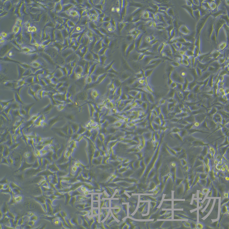 MC38-OVA细胞（小鼠结肠癌细胞/大鼠结肠癌-OVA 鸡基因修饰）LM8C0802-OVA