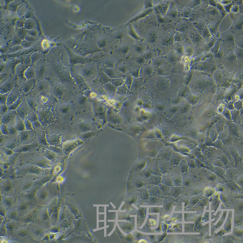 OAW28细胞（卵巢上皮性肿瘤细胞）LM8C1139