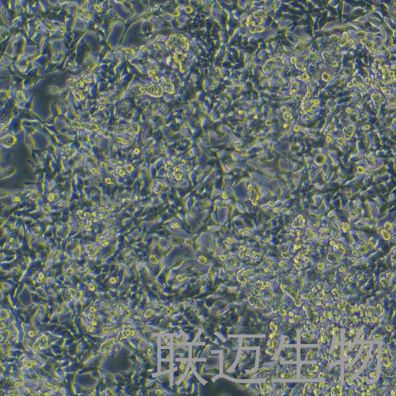 GP2d细胞（结肠癌细胞）LM8C1141