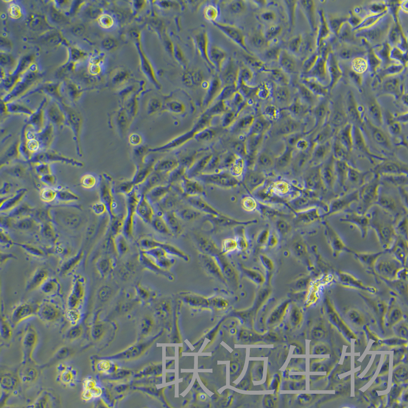 FTC238细胞（滤泡状甲状腺癌细胞，肺转移）LM8C1150