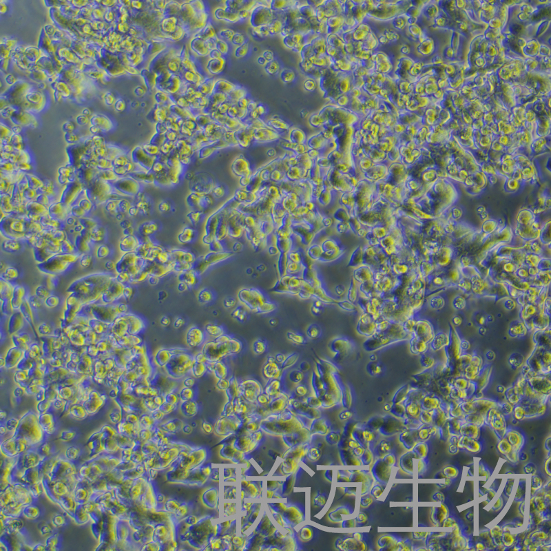 IM95m细胞（胃癌细胞）LM8C1151