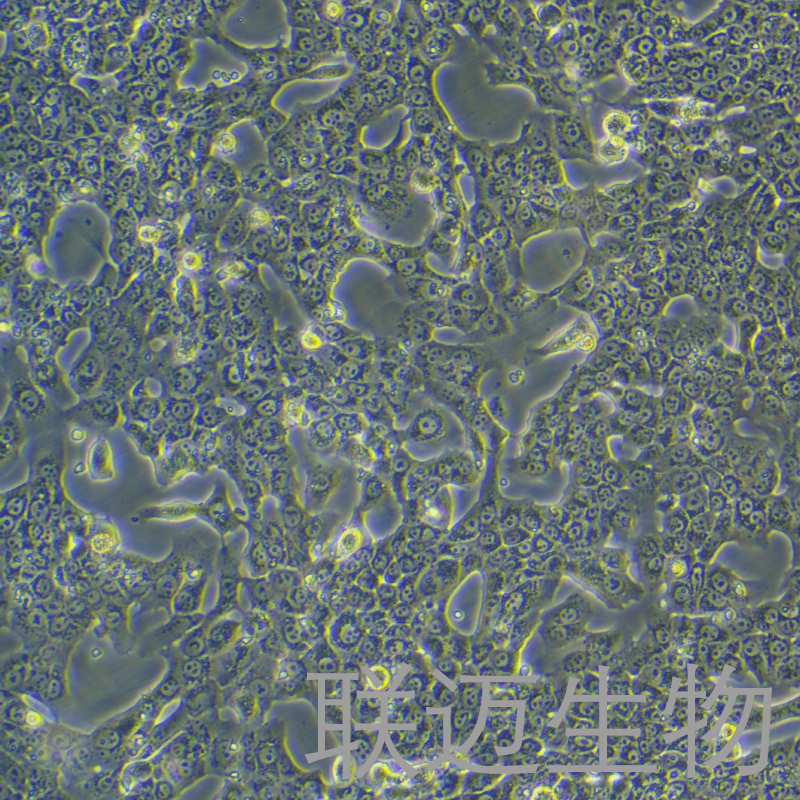 Capan-1细胞（胰腺癌细胞）LM8C1167