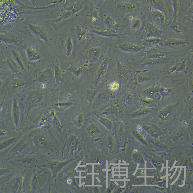 hcaec（人冠状动脉内皮细胞）YB-70467HC