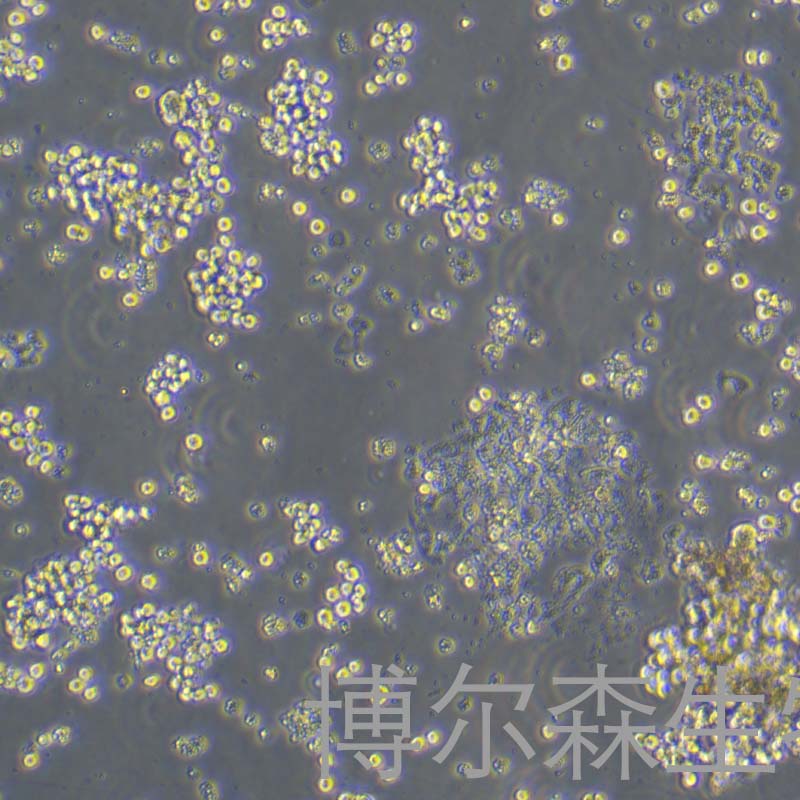 HSC-39细胞（人胃癌细胞）