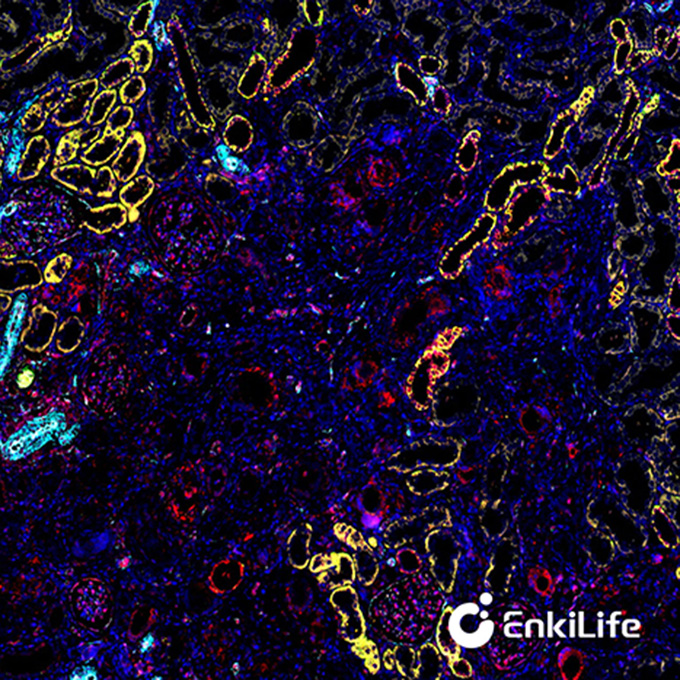 TSA五标六色多重荧光染色试剂盒（mIHC）| EnkiLife