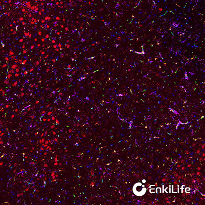 TSA五标六色多重荧光染色试剂盒（mIHC）| EnkiLife