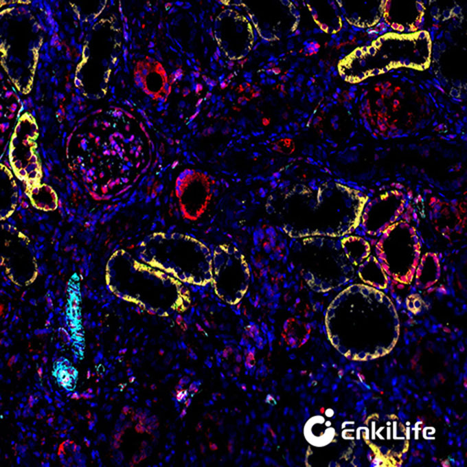 TSA五标六色多重荧光染色试剂盒（mIHC）| EnkiLife