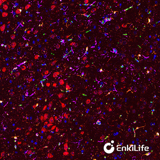 TSA五标六色多重荧光染色试剂盒（mIHC）| EnkiLife