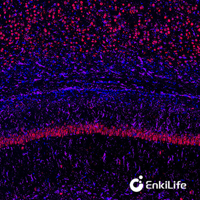 TSA双标三色多重荧光染色试剂盒（mIHC）|  EnkiLife