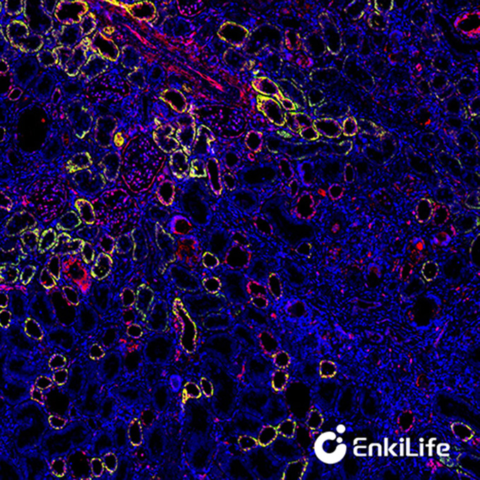 TSA双标三色多重荧光染色试剂盒（mIHC）|  EnkiLife