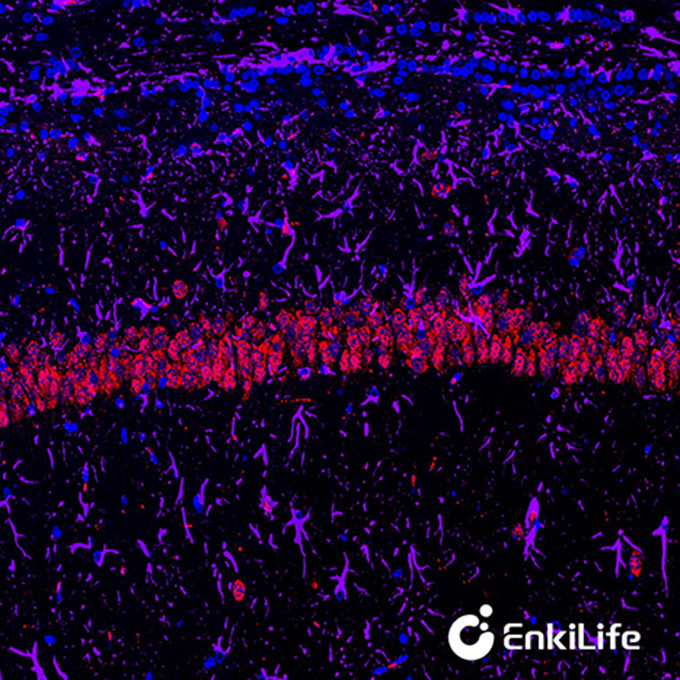 TSA双标三色多重荧光染色试剂盒（mIHC）|  EnkiLife