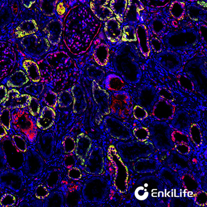 TSA双标三色多重荧光染色试剂盒（mIHC）|  EnkiLife