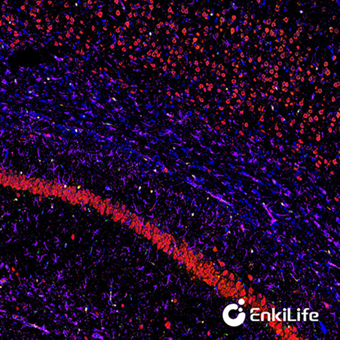 TSA四标五色多重荧光染色试剂盒（mIHC）| EnkiLife