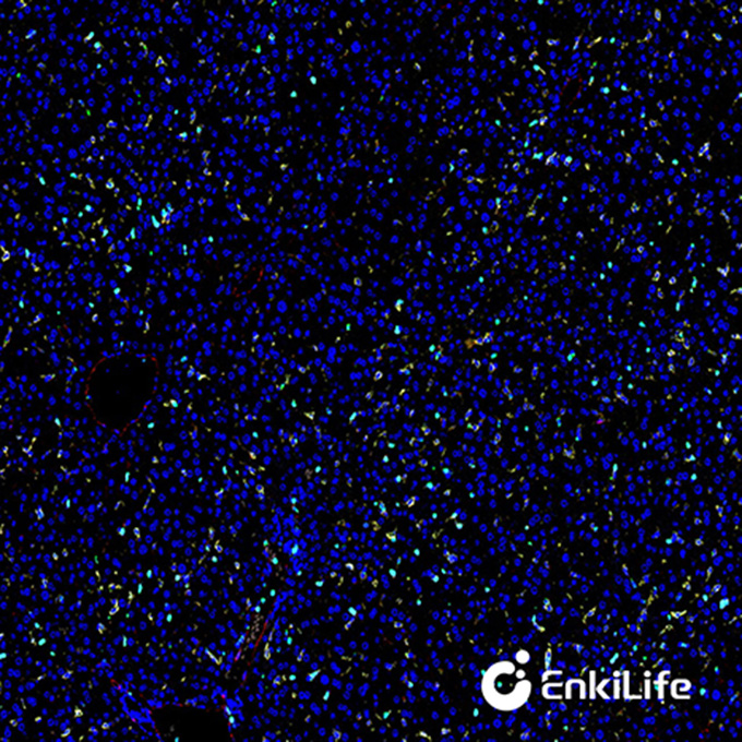 TSA四标五色多重荧光染色试剂盒（mIHC）| EnkiLife