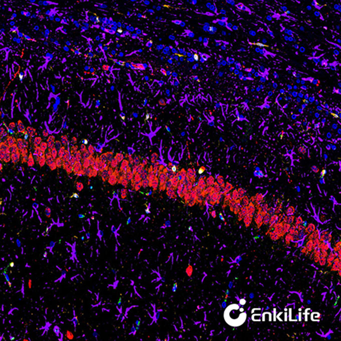TSA四标五色多重荧光染色试剂盒（mIHC）| EnkiLife