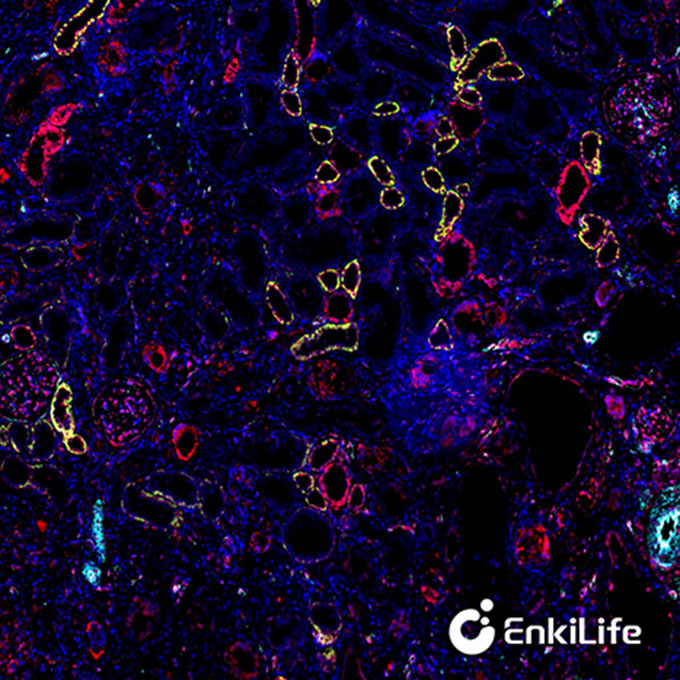 TSA三标四色多重荧光染色试剂盒（mIHC）| EnkiLife