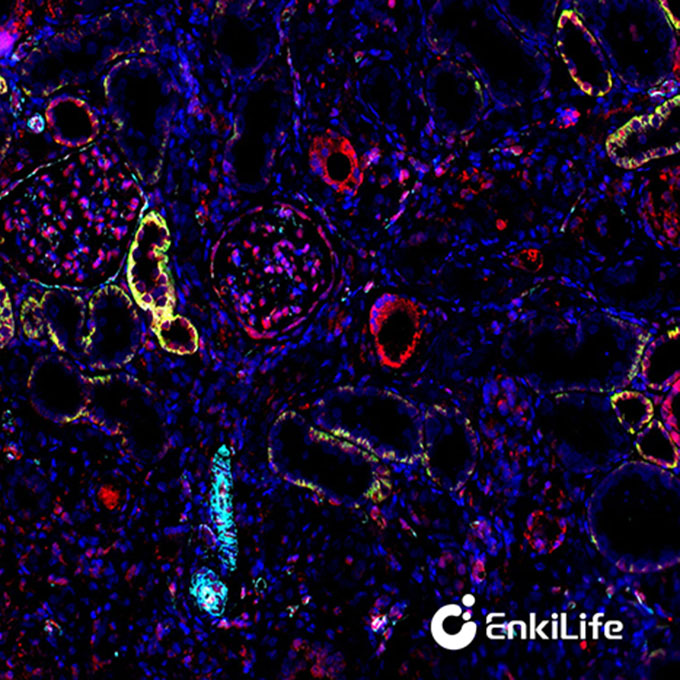 TSA三标四色多重荧光染色试剂盒（mIHC）| EnkiLife