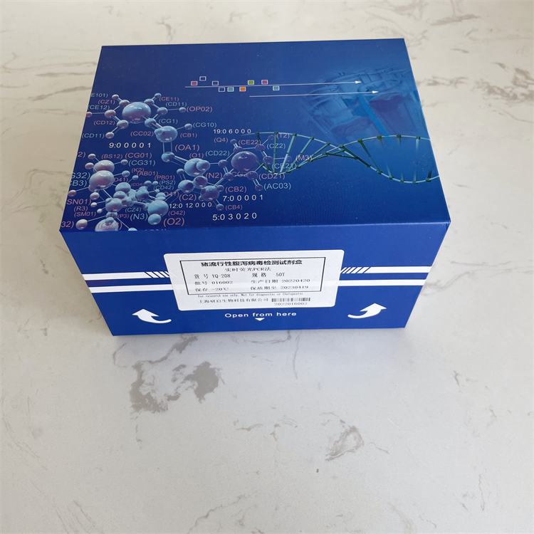 人富含半胱氨酸型酸性蛋白(SPARC）ELISA试剂盒