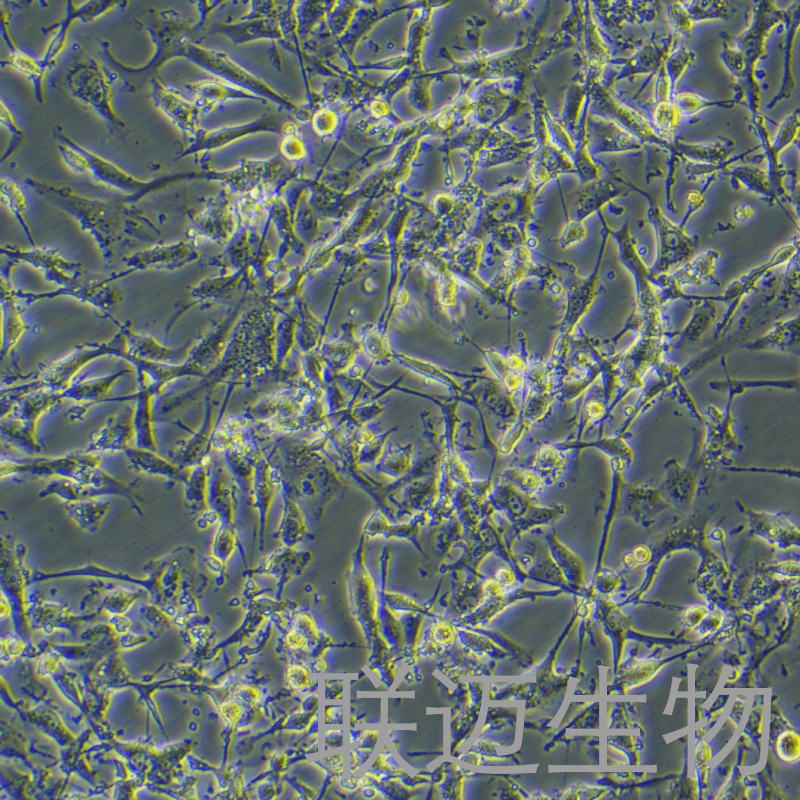 U87MG-LUC细胞（恶性胶质瘤细胞带荧光素酶）LM8C0238-L