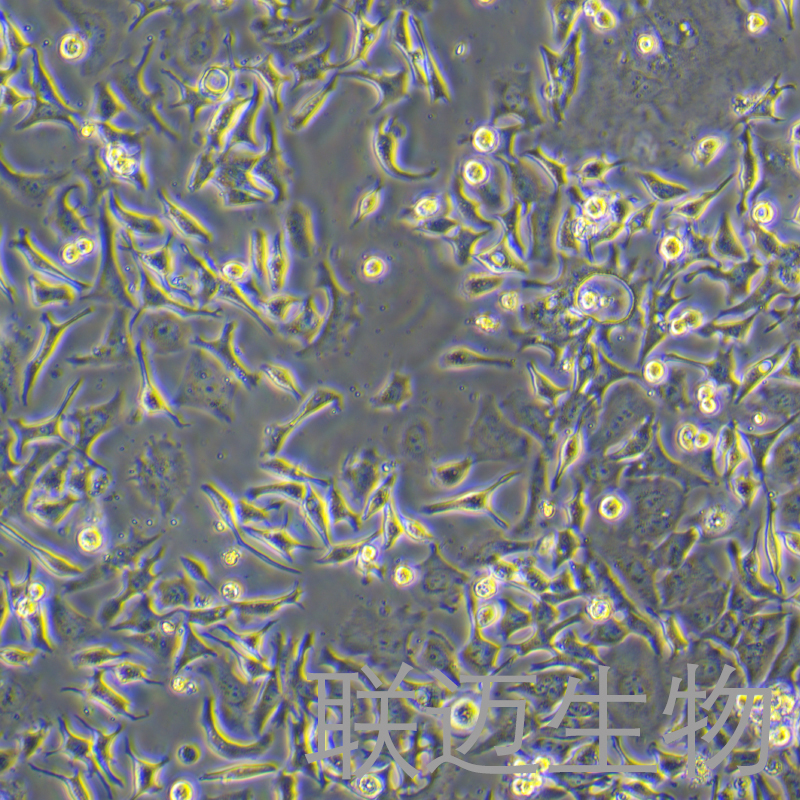 HCC1954细胞（乳腺导管癌细胞）LM8C1196