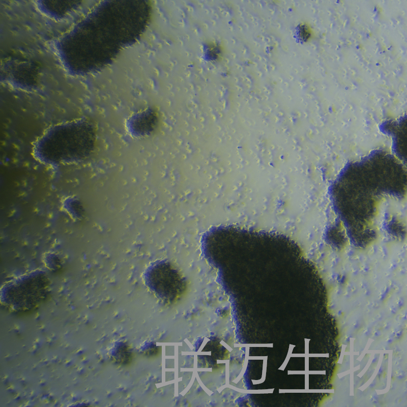 MJ细胞（原发性皮肤 T 细胞非霍奇金淋巴瘤）LM8C1194