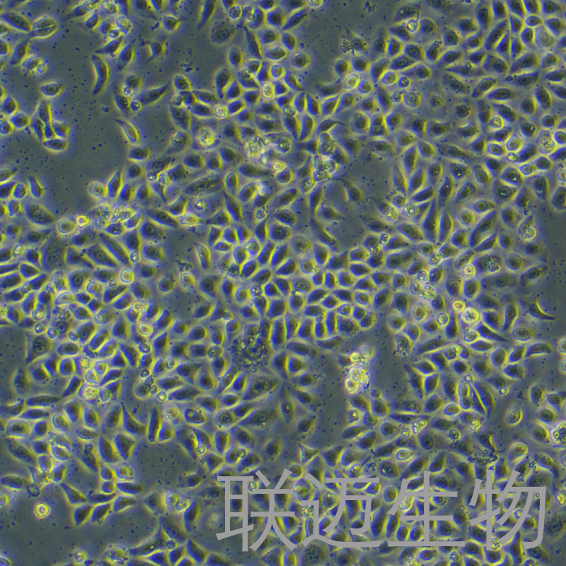 VK2/E6E7细胞（子宫内膜异位症阴道粘膜上皮细胞）LM8C1190