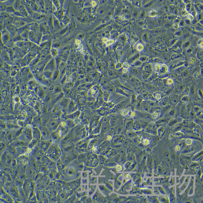 EFO-27细胞（卵巢腺癌细胞）LM8C1188