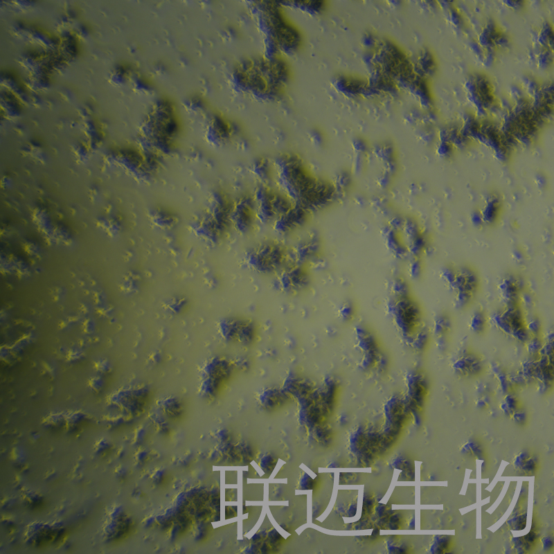 DMS-153细胞（小细胞肺癌细胞）LM8C1209