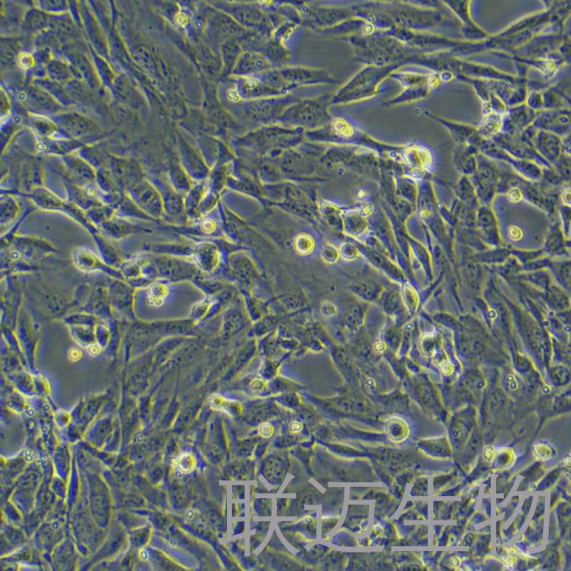 SK-LMS-1细胞（人阴户平滑肌肉瘤复苏细胞）LM8C1248