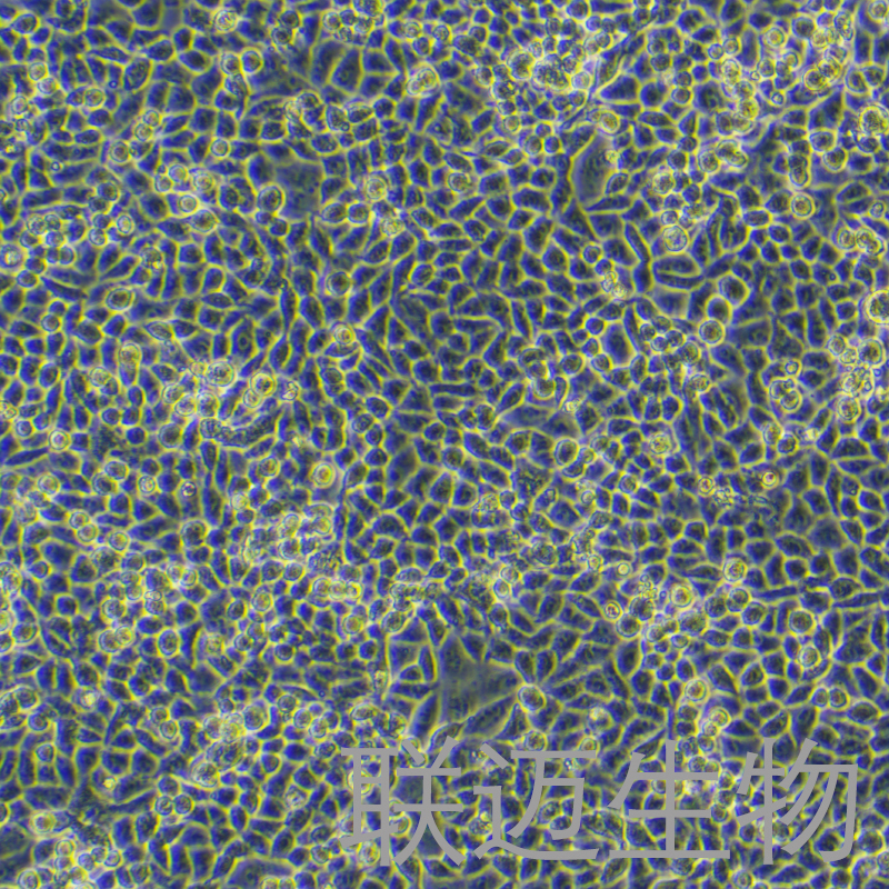 A2780/DDP细胞（人卵巢癌顺铂耐药株）LM8C0013D2