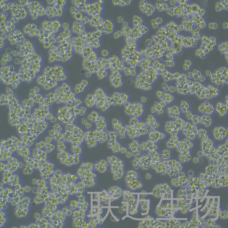 A20-Luc细胞（小鼠B细胞淋巴瘤细胞带荧光素酶）LM8C0955-L